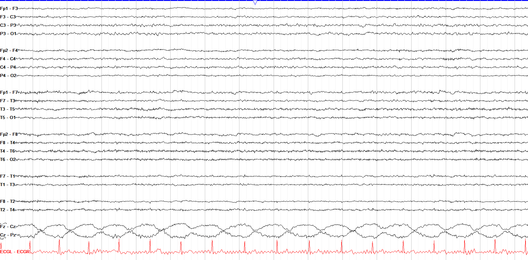 Cardioballistic
