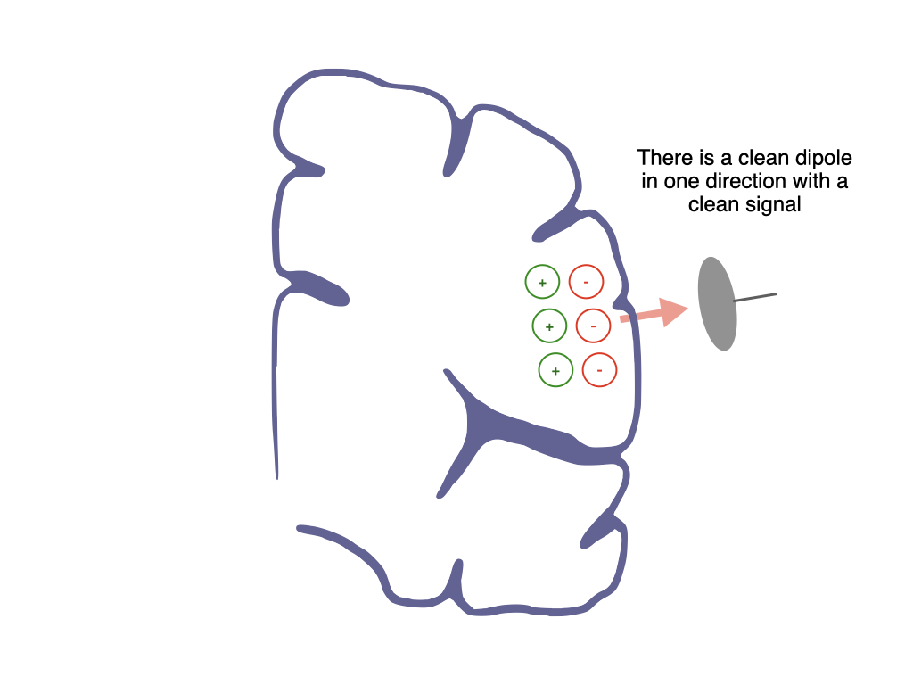 Optimal perpendicular dipole with a clean signal