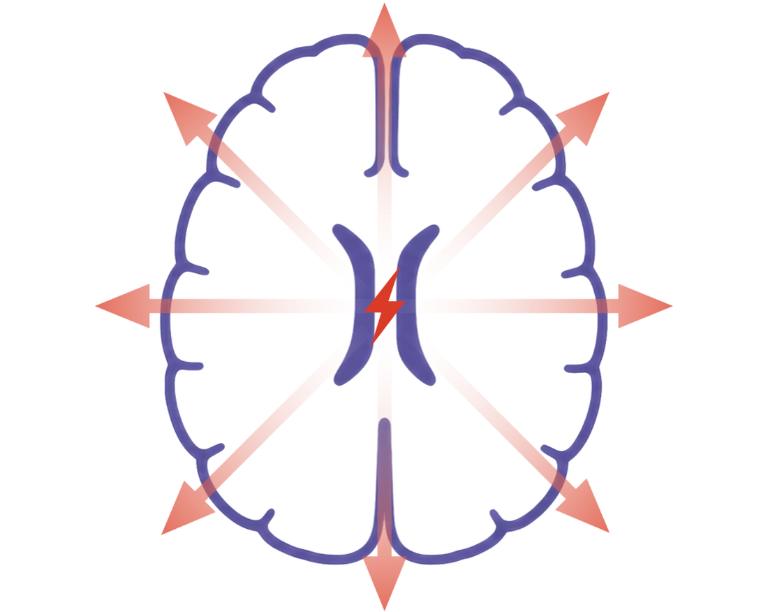Axial schematic of a generalized discharge spreading in all directions at once