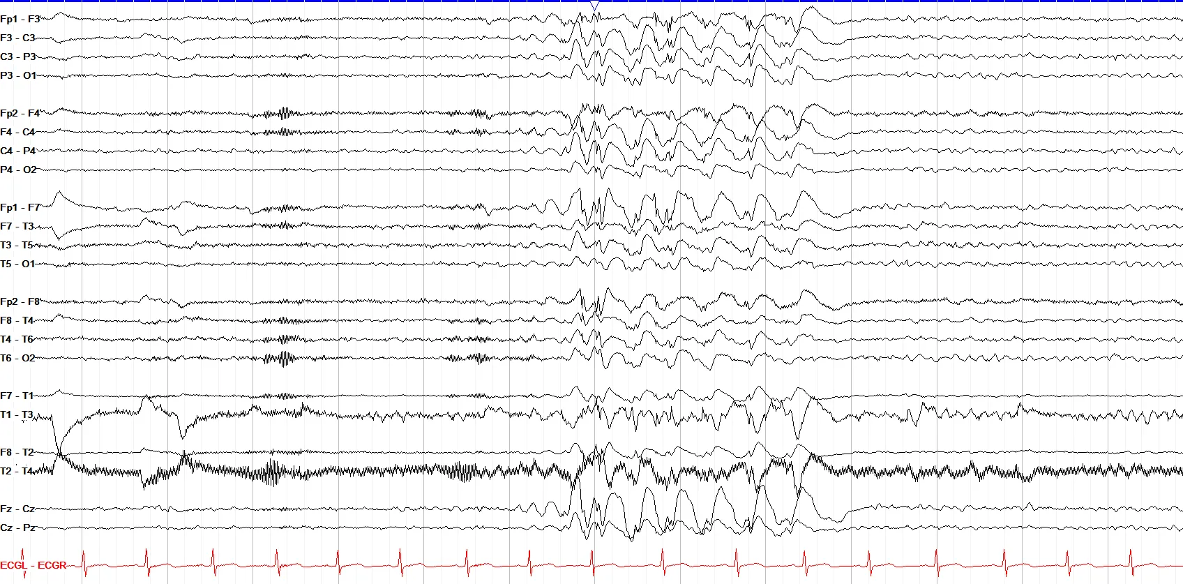 Generalized polyspike & waves