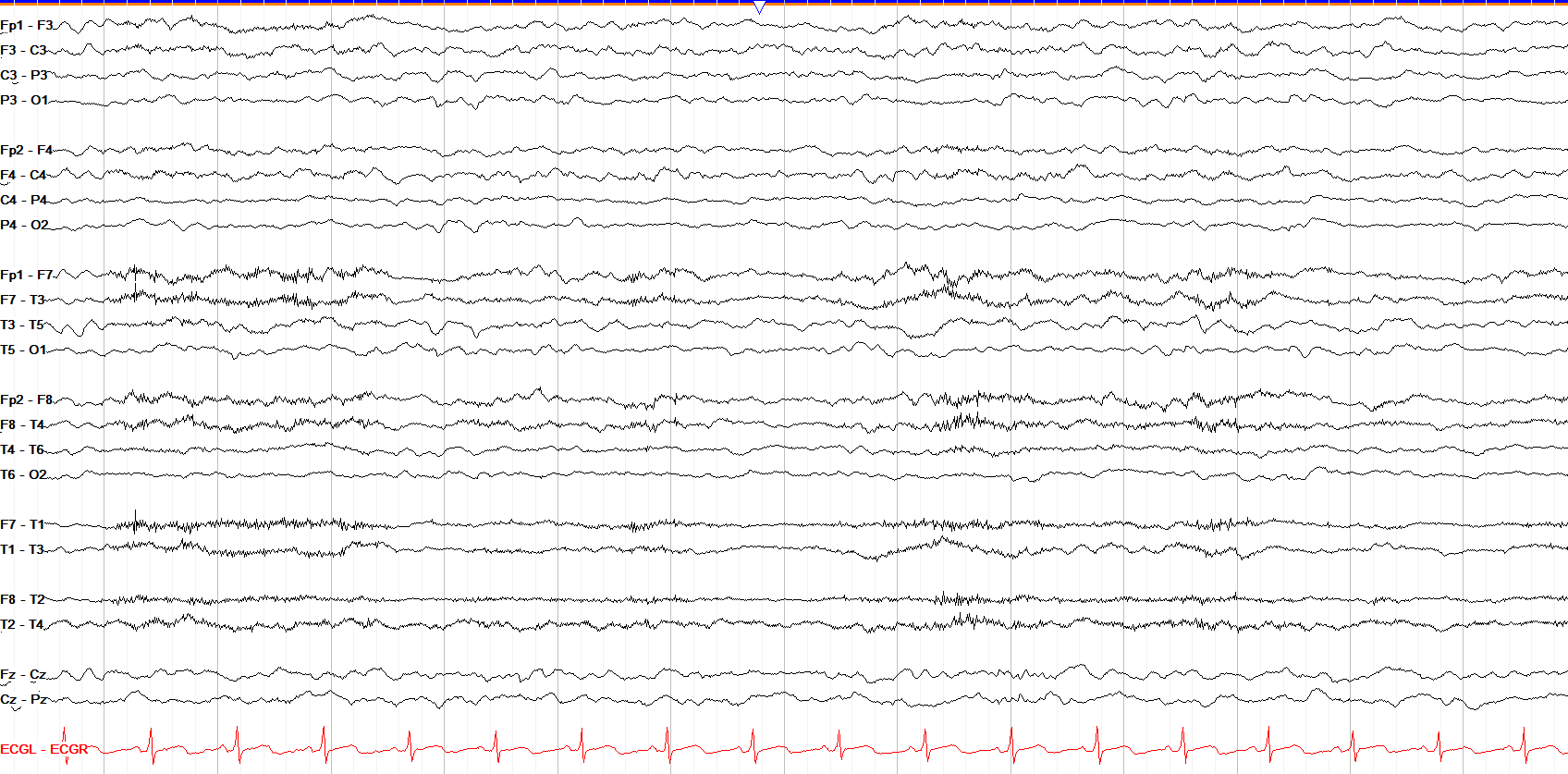 Moderate generalized slowing