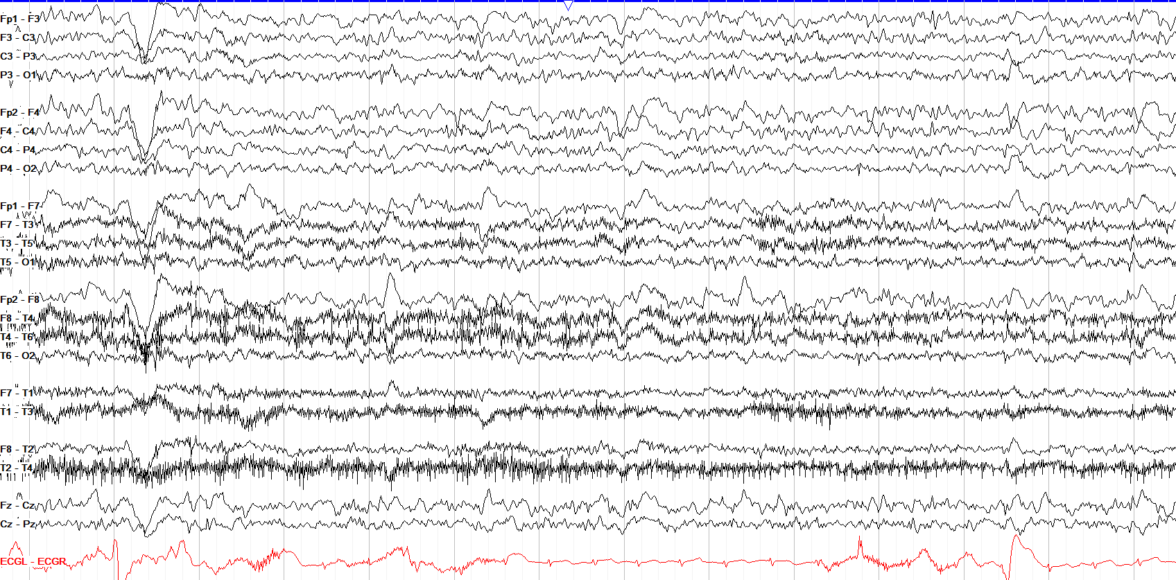 Mild generalized slowing