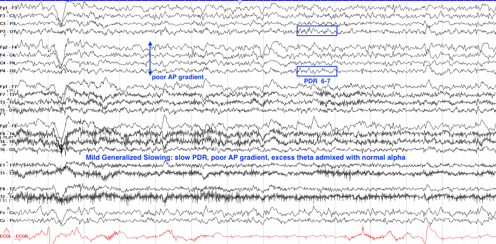 Mild Generalized Slowing