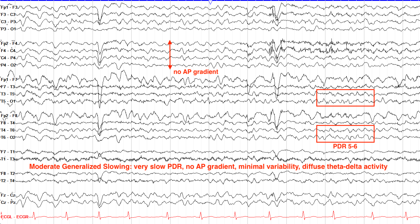 Moderate Generalized Slowing