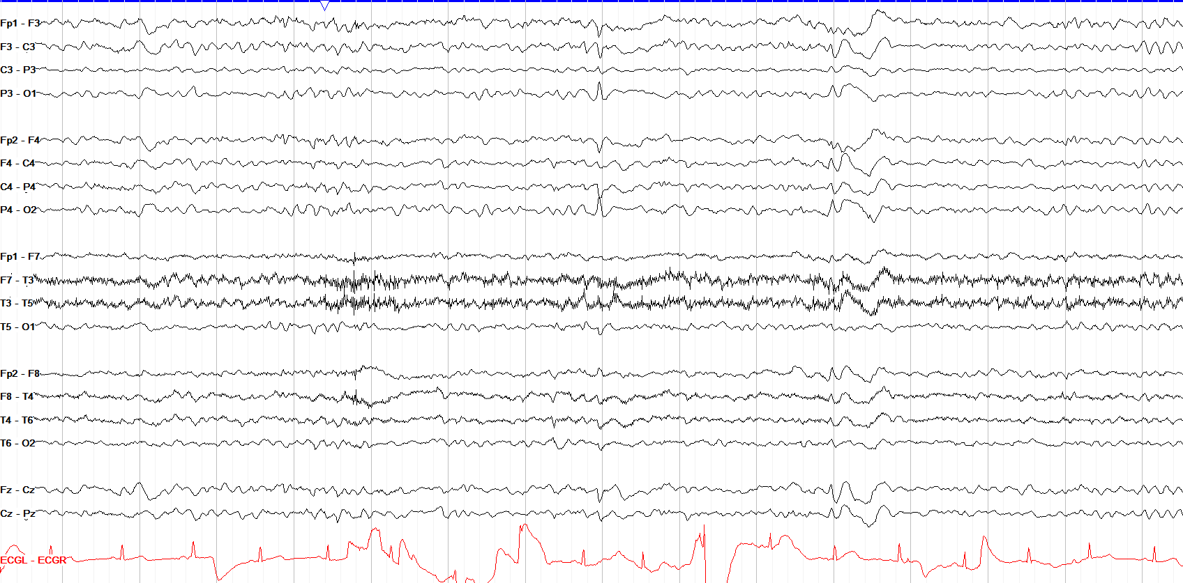 Vertex waves I