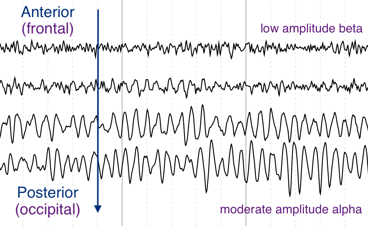 Anterior-posterior gradient showing faster, lower amplitude frequencies in frontal regions and slower, higher amplitude frequencies in occipital regions