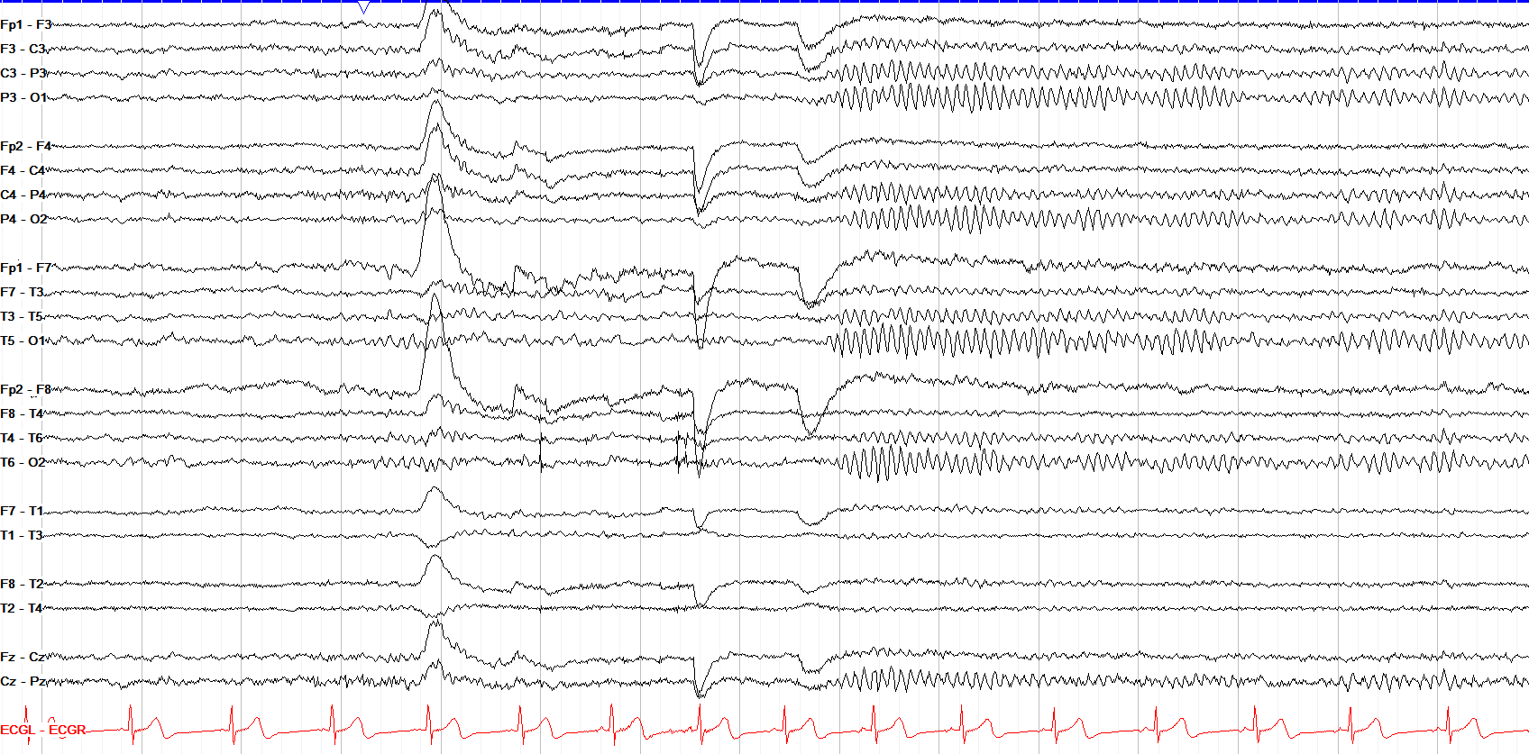 PDR Emergence