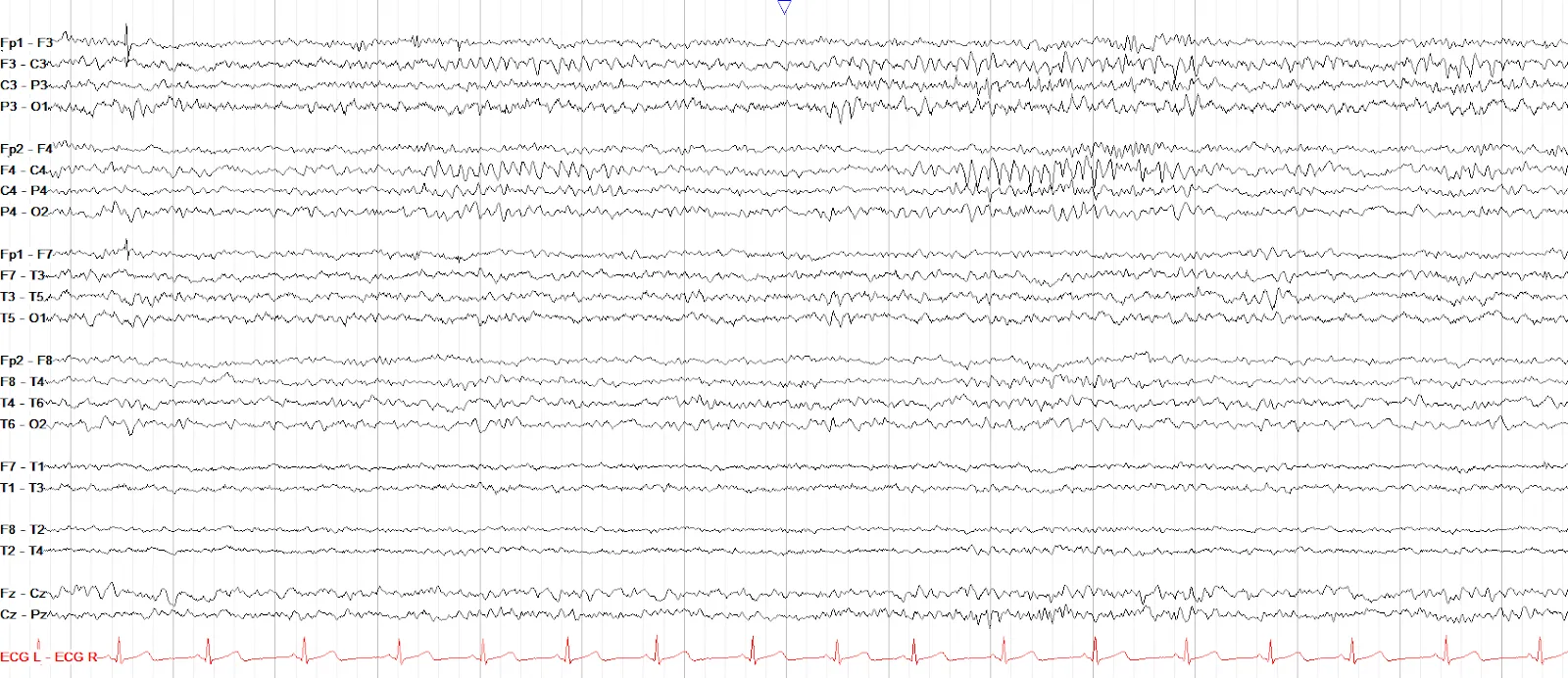 Mu Rhythm