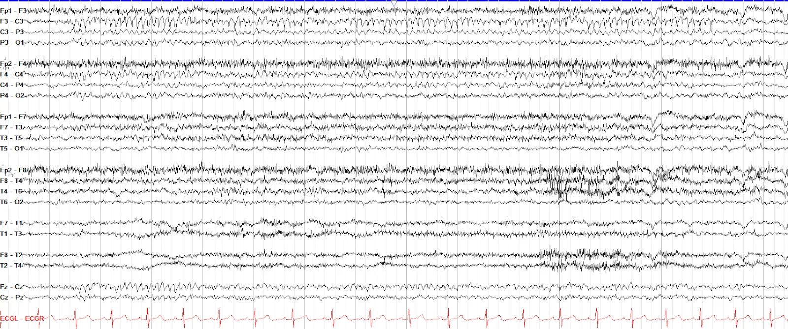 Mu Rhythm