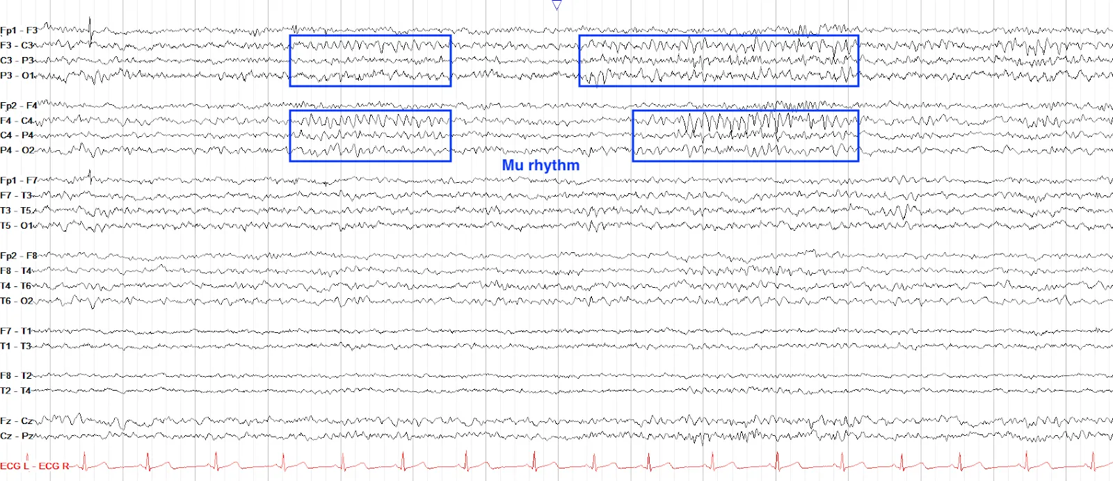Mu Rhythm annotated