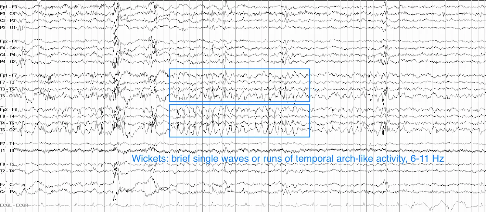 Wicket waves in temporal chains