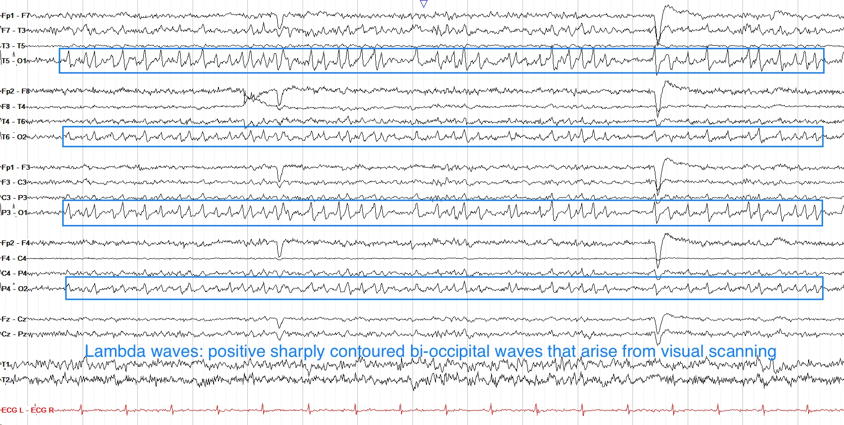 Lambda waves