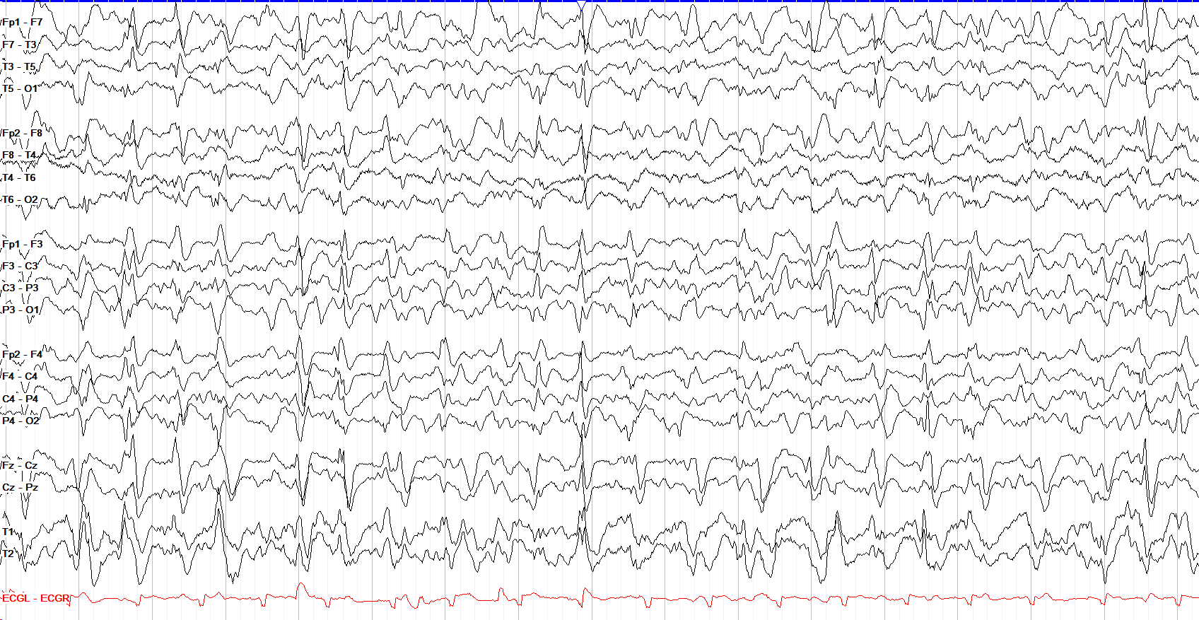 GPDs with mixed morphologies