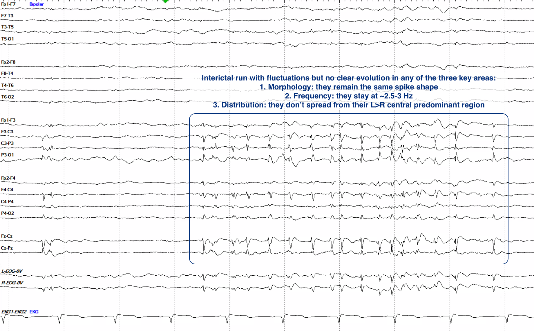 Answer - periodic interictal run, annotated with the three evolution criteria