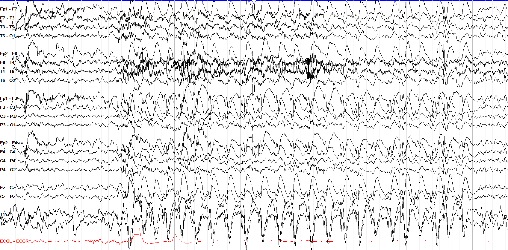 Monomorphic Activity