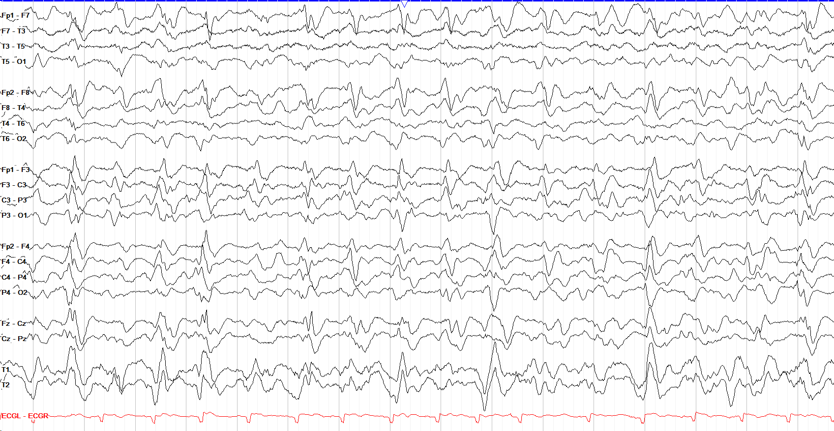 Periodicity