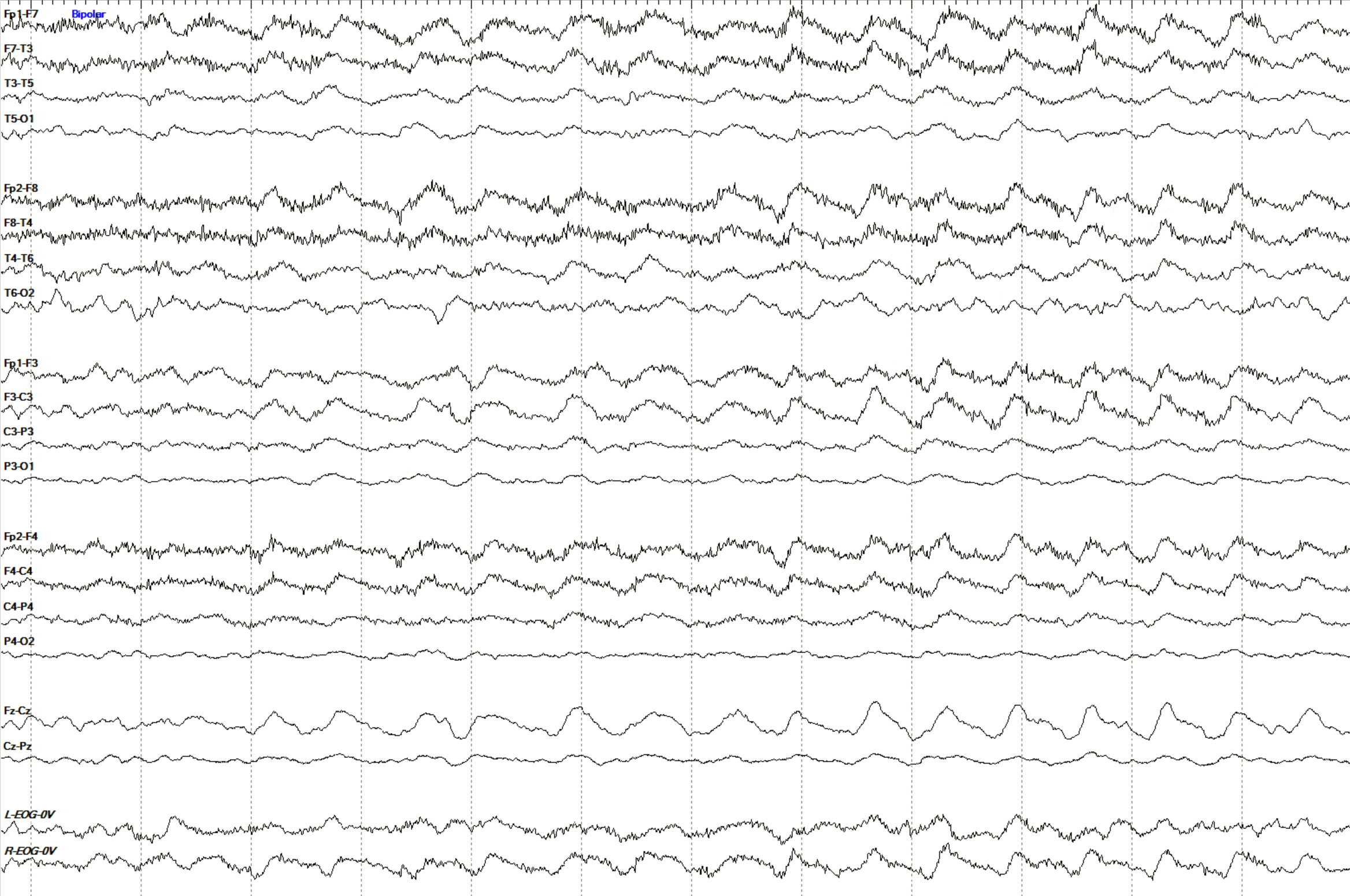 Rhythmicity